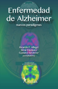 ENFERMEDAD DE ALZHEIMER 