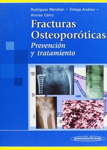 FRACT. OSTEOPORÓTICAS